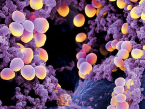 Staphylococcus aureus bacteria, which may produce a powerful new antibiotic 