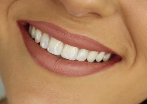 A smiling woman who has good dental health