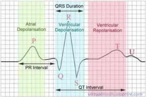 A normal ECG tracing shows electrical activity of the heart 