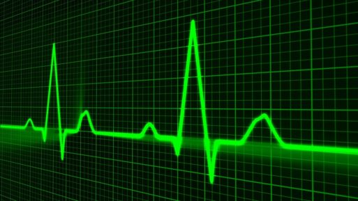 Neon green graph of heart rate