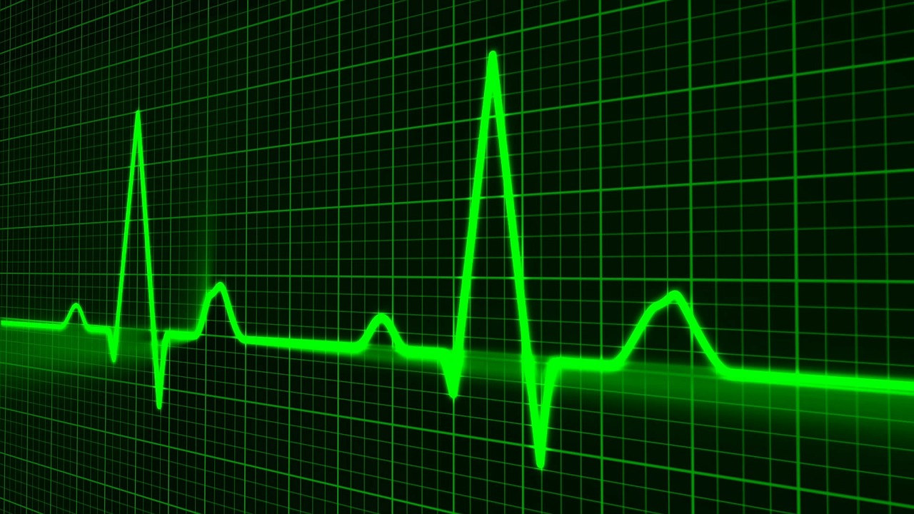 Neon green graph of heart rate