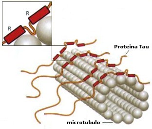 An illustration of a tau protein tangling itself onto brain matter, one of the signs of Alzheimer's