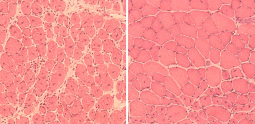 Mice Muscle Cells (old right) Credit: www.livescience.com