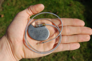 A man holding a pacemaker, which doesn't have to be removed during alkaline hydrolysis