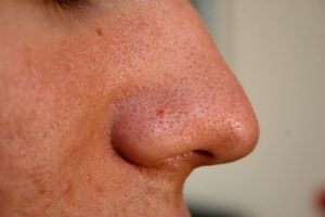 A close-up photo of a nose for odor test