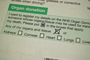 A question written on a piece of paper asking whether the patient would like to become an organ donor