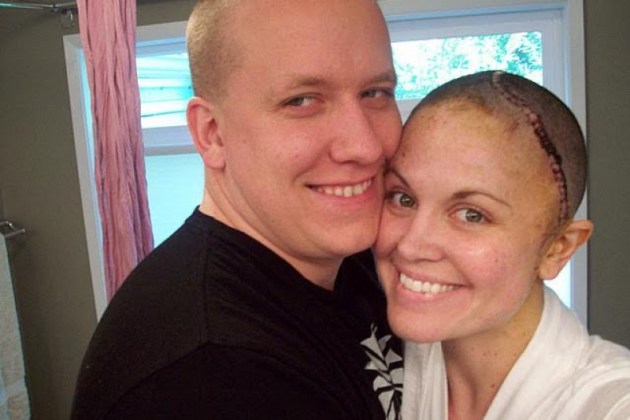 Jess Oldwyn and her husband stand hugging each other after her brain surgery as shown in "My Last Days."