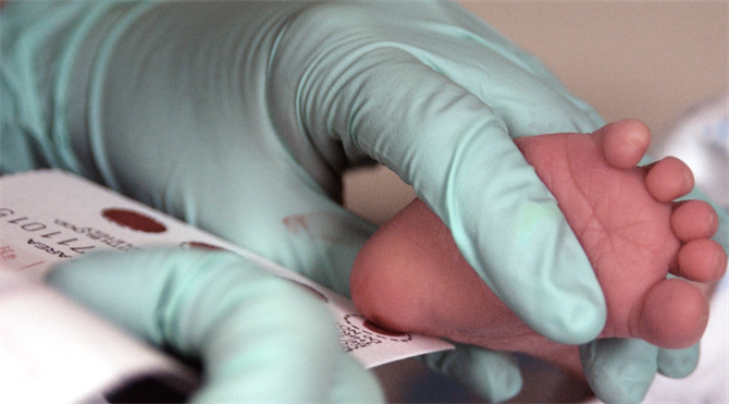 A photo of a doctor holding a child's foot to get a blood sample and test for genetic diseases, similar to the one depicted in Butler's "The Evening the Morning and the Night"