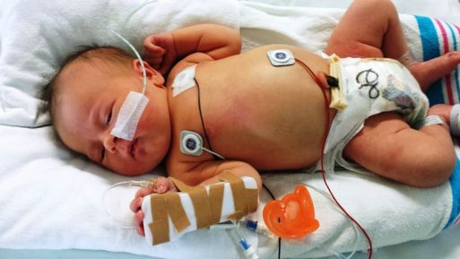 A baby in intensive care is one of American children who may not see adulthood