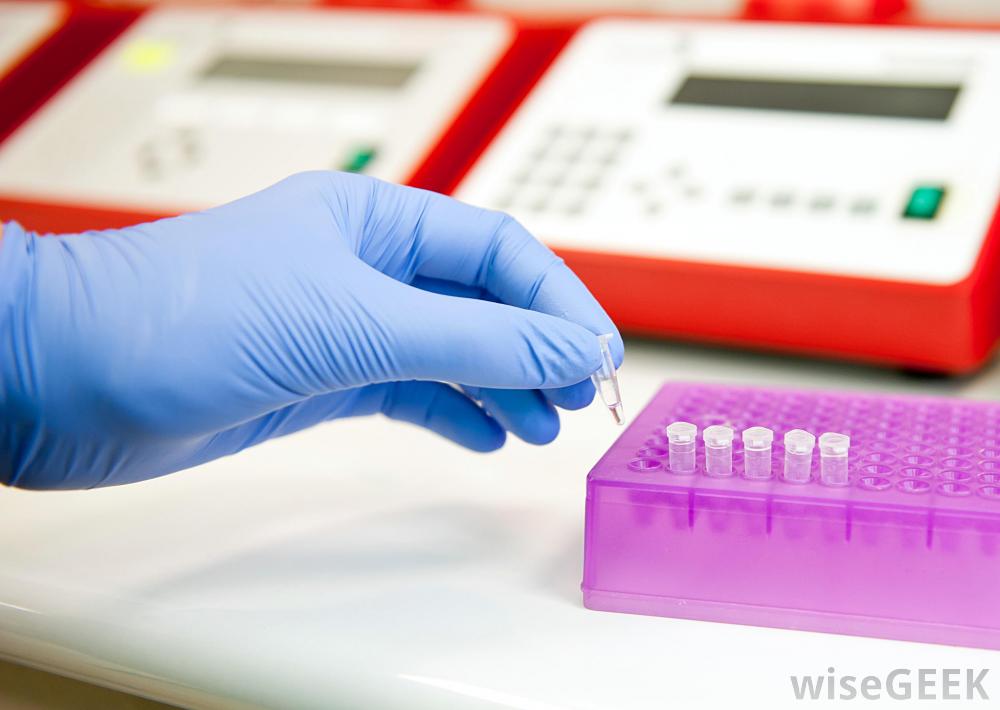 genetic assay testing for early-stage breast cancer