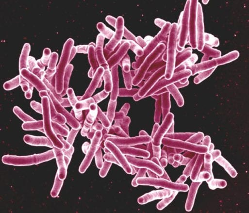 Mycobacterium tuberculosis causes XDR TB