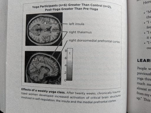 Image from "The Body Keeps the Score" by Dr. Bessel van der Kolk showing how yoga can help heal the physiological effects of trauma