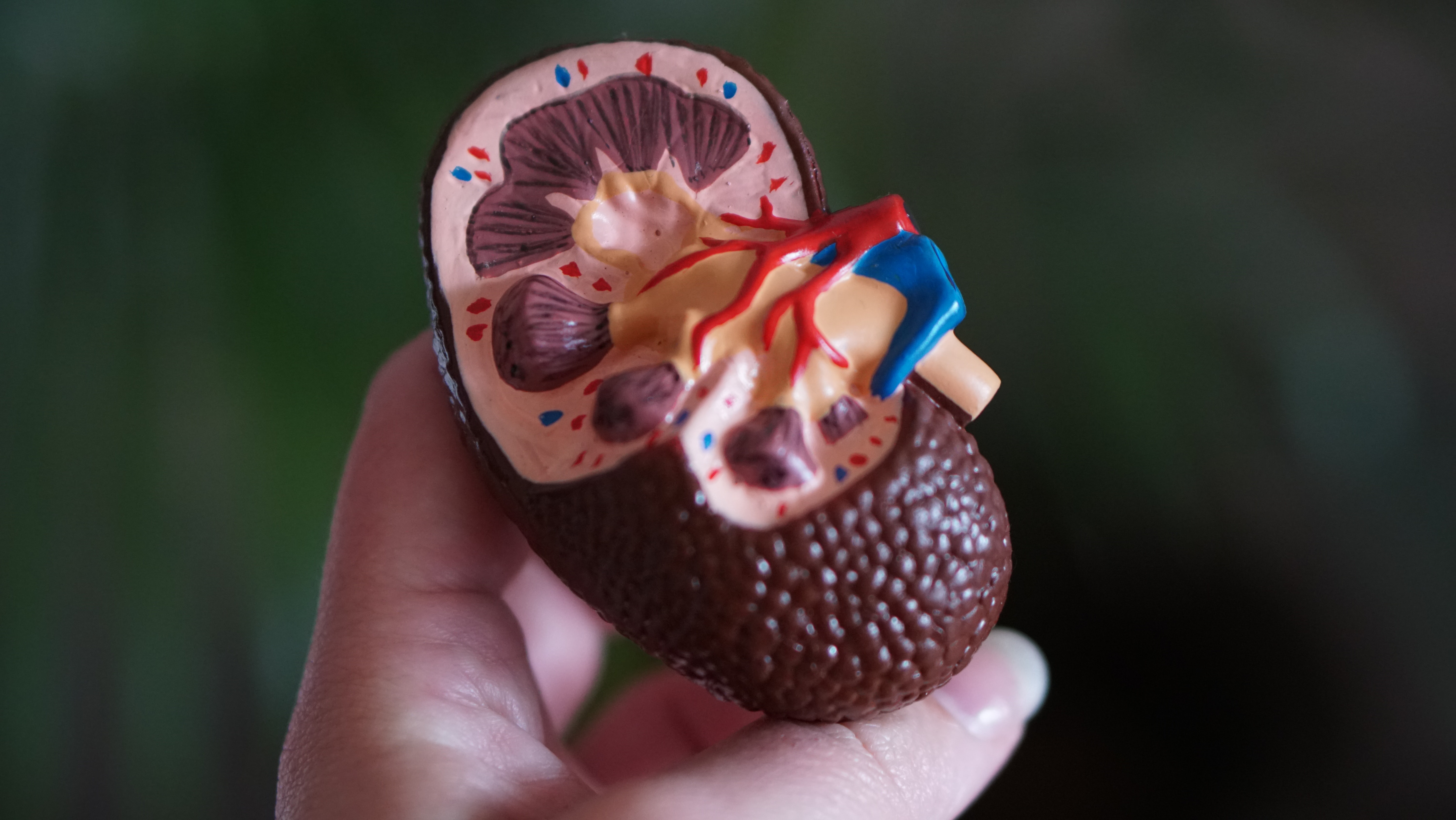 Kidney Cross Section