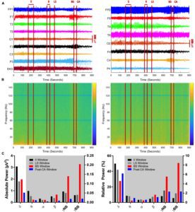 eeg of a brain as we die