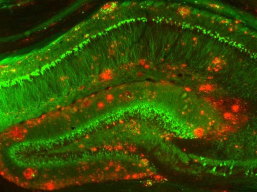 mouse model shows beta amyloid in mouse model