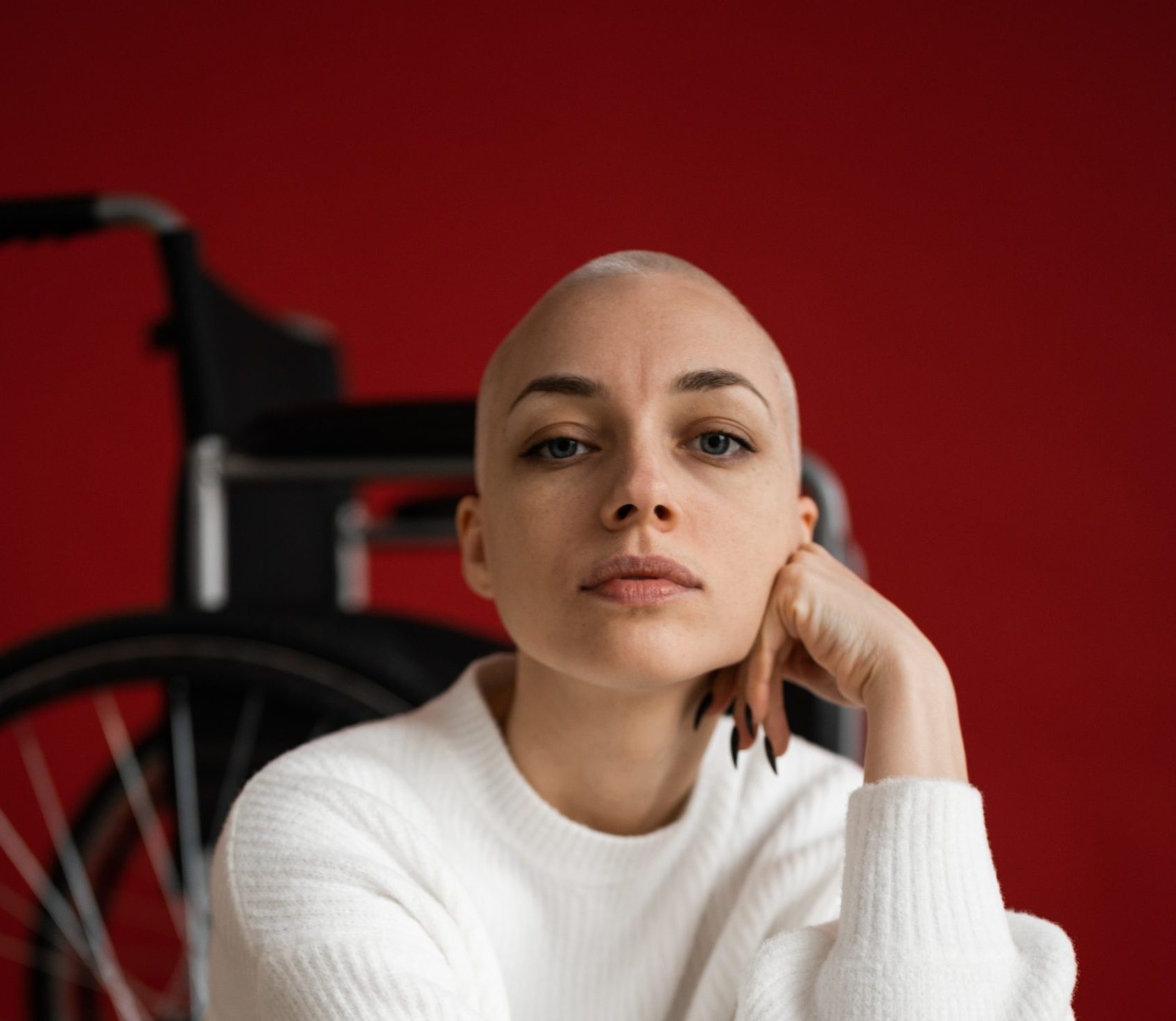 young adult with no hair demonstrates cancer survivorship